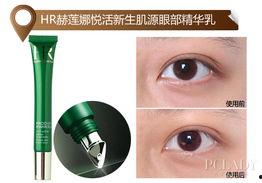 眼部细纹图片,眼部细纹成因解析与改善策略